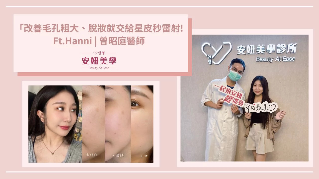 hanni星皮秒
