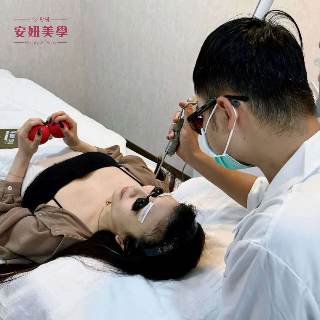 hanni星皮秒3