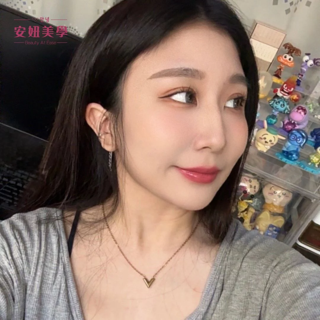 hanni星皮秒4